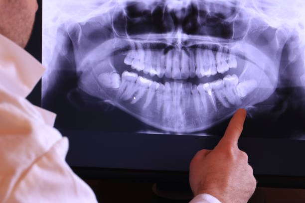 Best Broken or Cracked Tooth Emergency Dentist in Spring Hill, TN